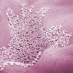 Psoriasi pustolosa generalizzata: nuovo farmaco migliora i sintomi %psoriasi pustolosa generalizzata: nuovo farmaco migliora i sintomicount(title)% Psoriasi pustolosa generalizzata: nuovo farmaco migliora i sintomi