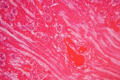 Trapiantati 2 reni di maiale in un ricevente umano
