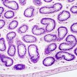 Infertilità maschile: scoperte nuove dinamiche genetiche