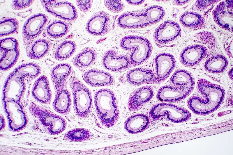 Infertilità maschile: scoperte nuove dinamiche genetiche