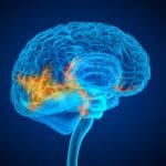 Glioma infantile: driver genetico ppm1d nuovo bersaglio farmacologico %glioma infantile: driver genetico ppm1d nuovo bersaglio farmacologicocount(title)% Glioma infantile: driver genetico ppm1d nuovo bersaglio farmacologico