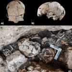 Chirurgia all'orecchio: reperti risalenti a 5300 anni fa