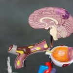 Cambiamenti simili all'alzheimer nei cervelli dei pazienti con covid 19 %cambiamenti simili all'alzheimer nei cervelli dei pazienti con covid 19count(title)% Cambiamenti simili all'alzheimer nei cervelli dei pazienti con covid 19