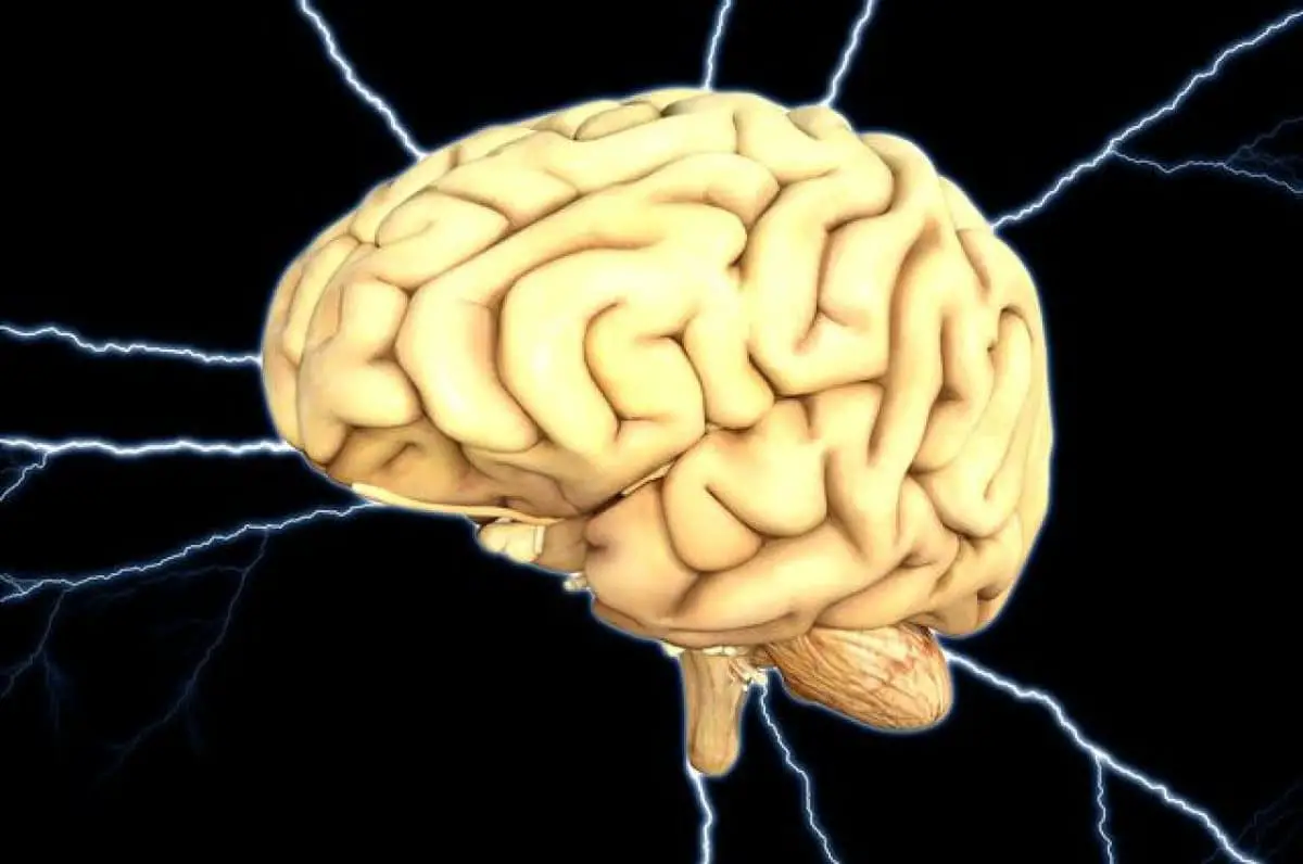 Cervello umano, paralisi cerebrale