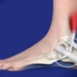Tendine artificiale sviluppato da cellule staminali umane 