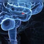 Crescita eccessiva dell'amigdala nei primi 12 mesi causa asd 