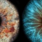 Cerotto con cellule staminali retiniche: dopo 2 anni funziona ancora