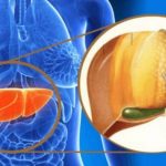 Come accendere il bruciagrassi naturale del corpo: la scoperta della proteina slit3 %come accendere il bruciagrassi naturale del corpo: la scoperta della proteina slit3count(title)% Come accendere il bruciagrassi naturale del corpo: la scoperta della proteina slit3