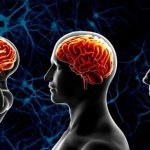 Alcol: eccedere causa atrofia cerebrale