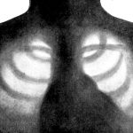 Chestlink: il 1º dispositivo a raggi x gestito da ia %chestlink: il 1º dispositivo a raggi x gestito da iacount(title)% Chestlink: il 1º dispositivo a raggi x gestito da ia