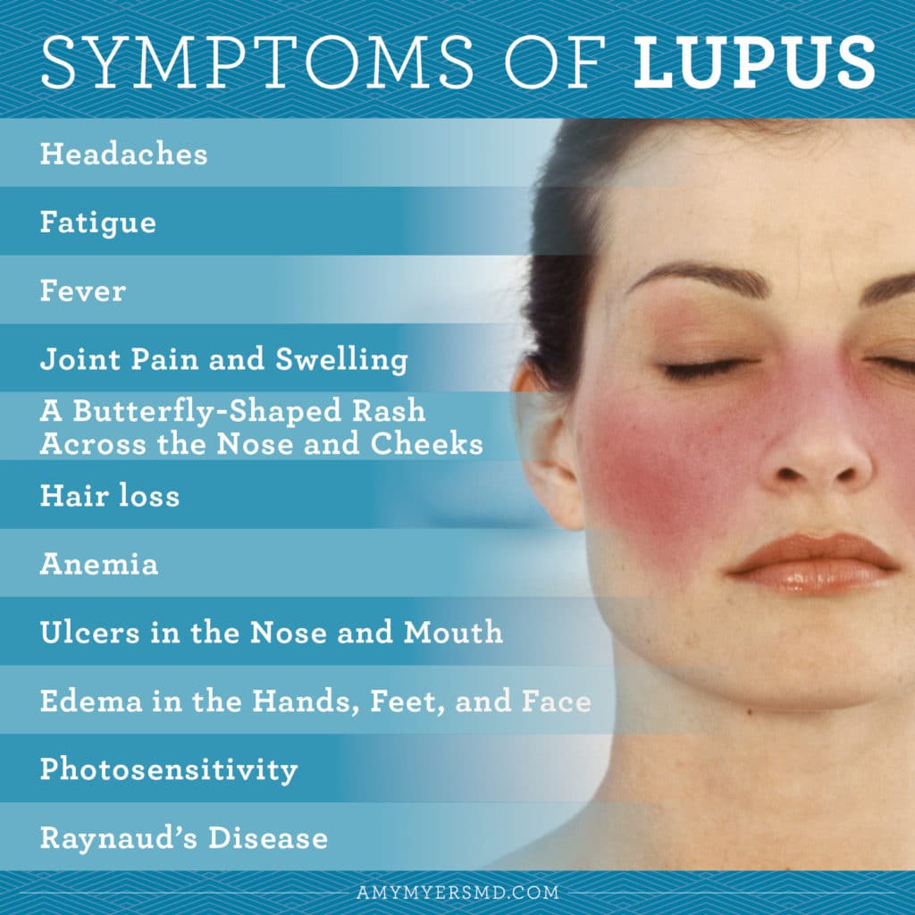 gene-tlr7-scoperta-la-possibile-causa-del-lupus