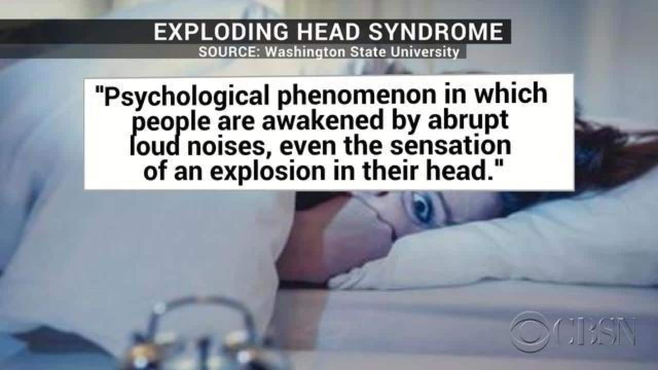 Sindrome della testa esplosiva