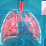 Microplastica nei polmoni riscontrato il 1° caso negli umani %microplastica nei polmoni riscontrato il 1° caso negli umanicount(title)% Microplastica nei polmoni riscontrato il 1° caso negli umani