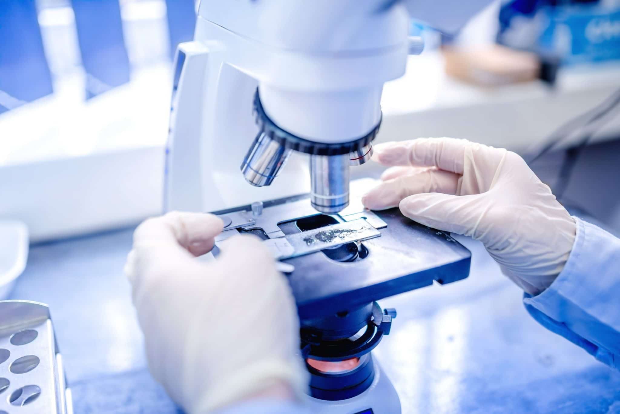 Archei asgard: come fanno a strisciare e cosa c'entra l'origine delle cellule? %archei asgard: come fanno a strisciare e cosa c'entra l'origine delle cellule? Count(title)% Analisi di campioni biologici al microscopio
