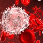 Leucemia promielocitica acuta: trovato target terapeutico