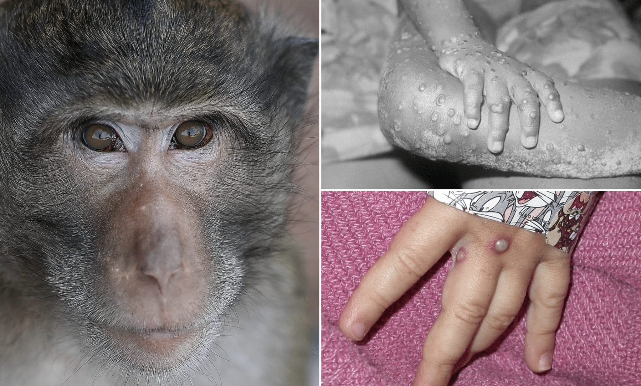 Smallpox of monkeys