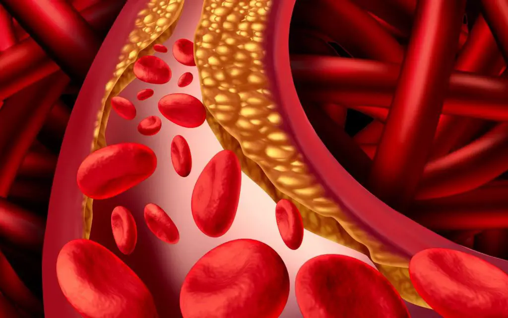 Arterial stiffness 