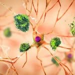 Alzheimer ad esordio giovanile: declino cognitivo più rapido %alzheimer ad esordio giovanile: declino cognitivo più rapidocount(title)% Alzheimer ad esordio giovanile: declino cognitivo più rapido