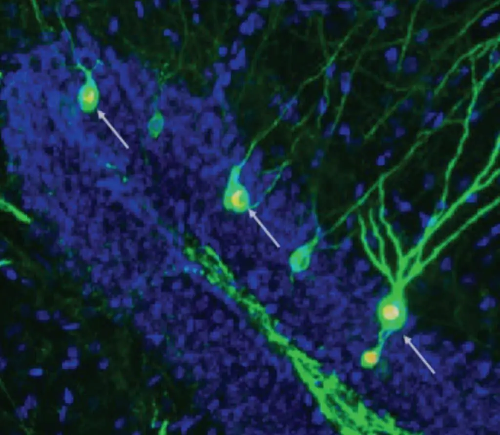 Produzione di nuovi neuroni 