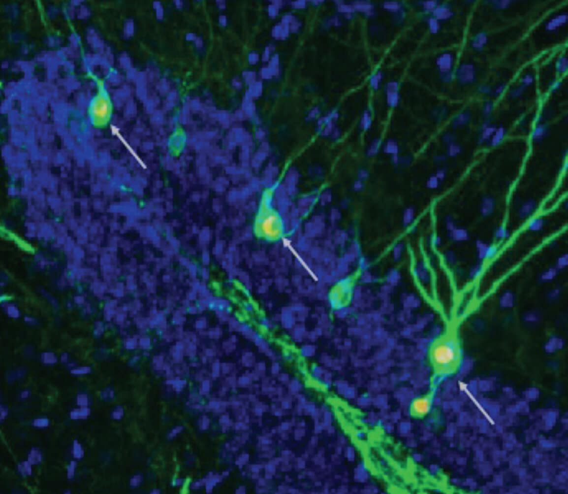 Ippocampo e parole: come il cervello rappresenta il significato %ippocampo e parole: come il cervello rappresenta il significatocount(title)% Neuroni e attività cerebrale, immagine illustrativa