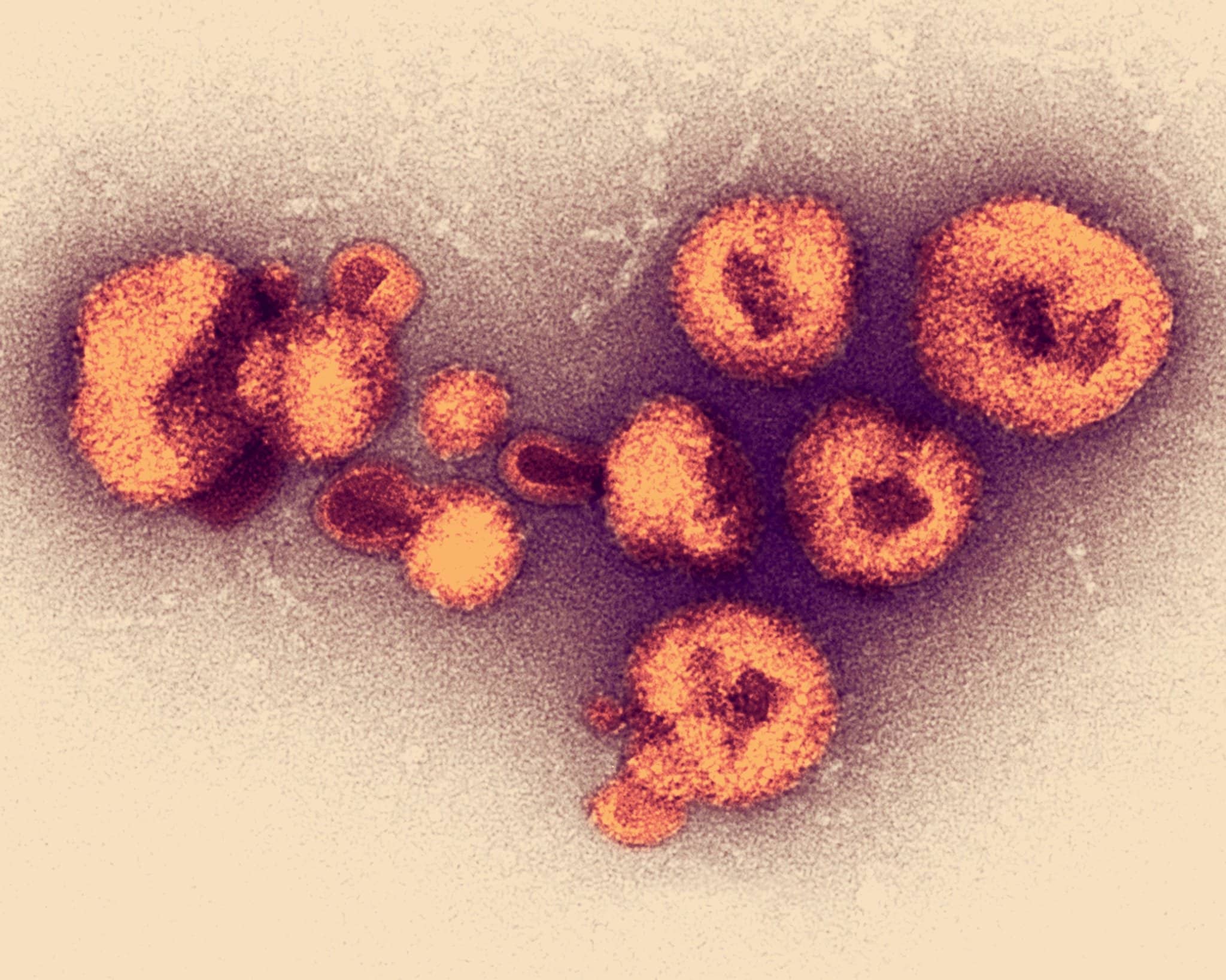 Virus Lassa, febbre di Lassa