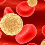 Colesterolo ldl: nuova terapia dna lo taglia quasi del 50%