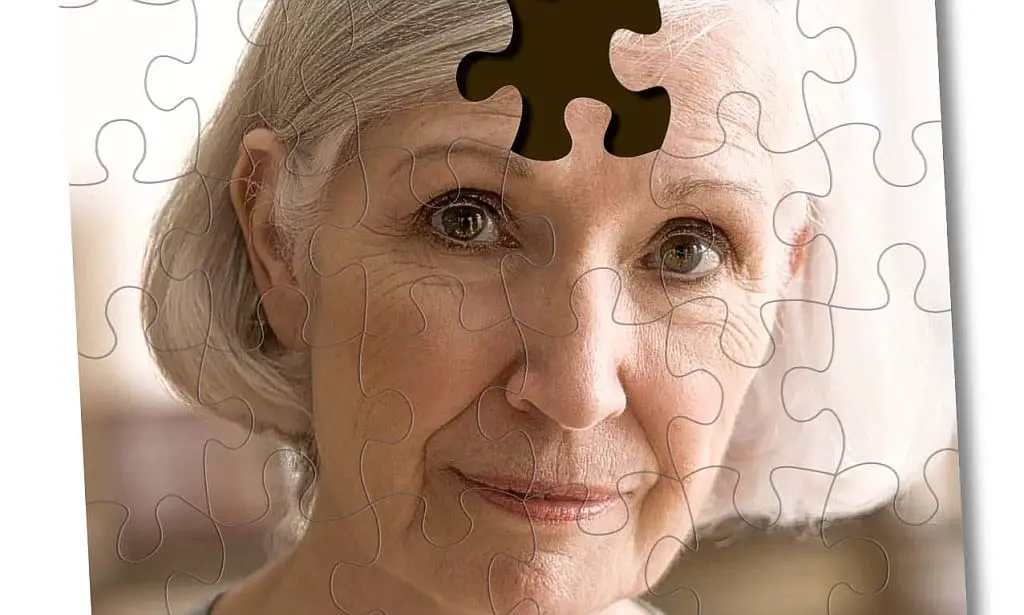 Alzheimer nelle donne