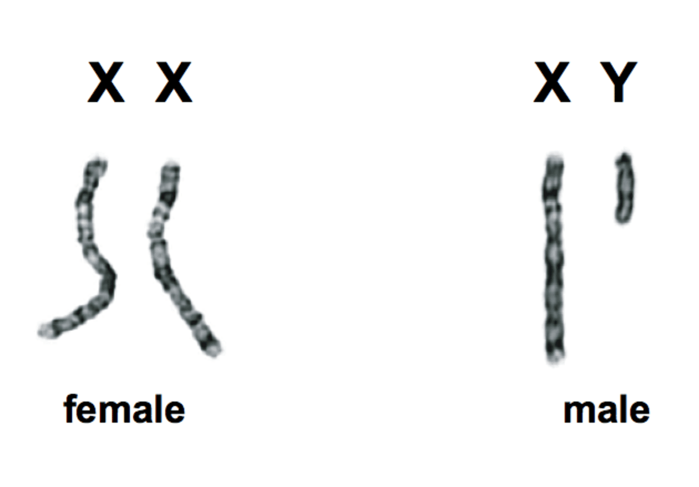 Cromosoma Y