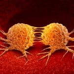 Metastasi e embrione: scoperta rivoluzionaria contro i tumori %metastasi e embrione: scoperta rivoluzionaria contro i tumoricount(title)% Metastasi e embrione: scoperta rivoluzionaria contro i tumori