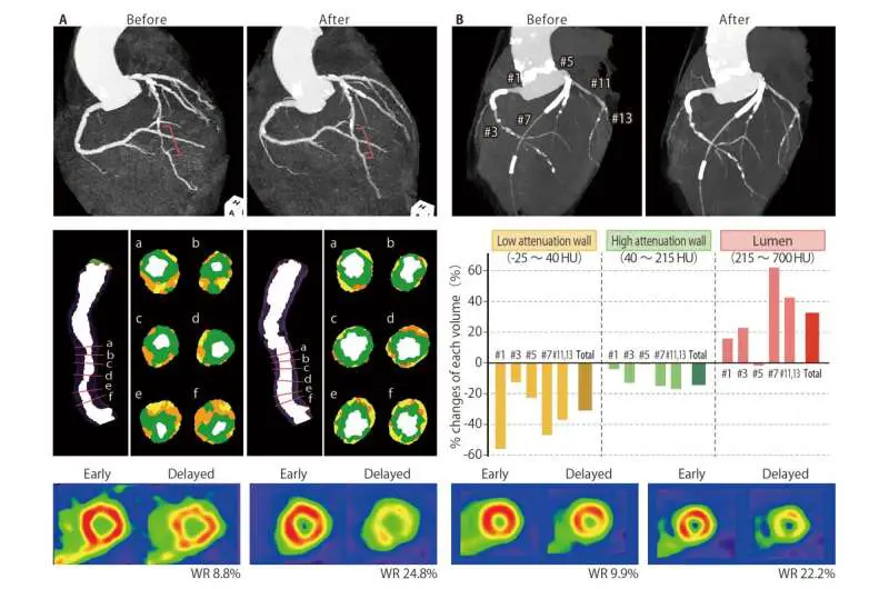 Malattie cardiache