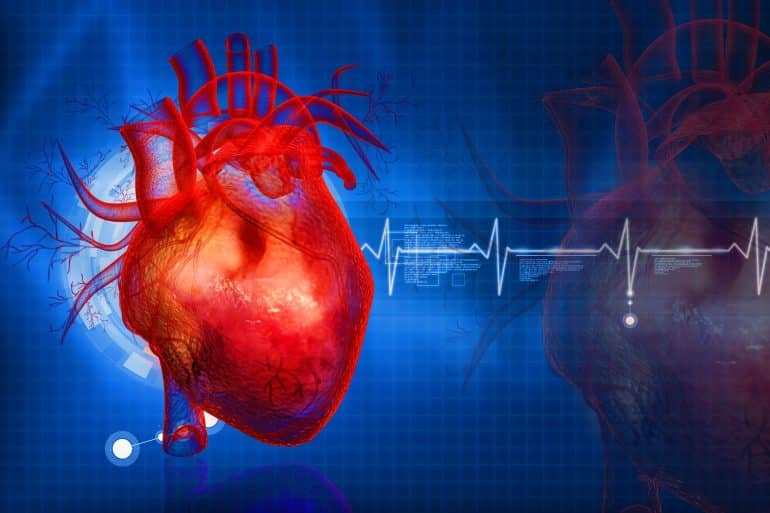 Trapianti cuore battente, insufficienza cardiaca, Amiloidosi cardiaca