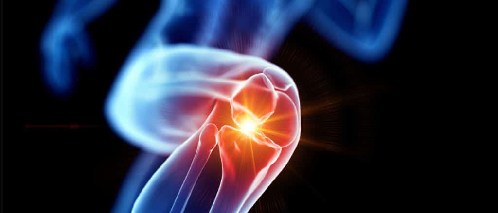 Artrite reumatoide, osteoartrosi 