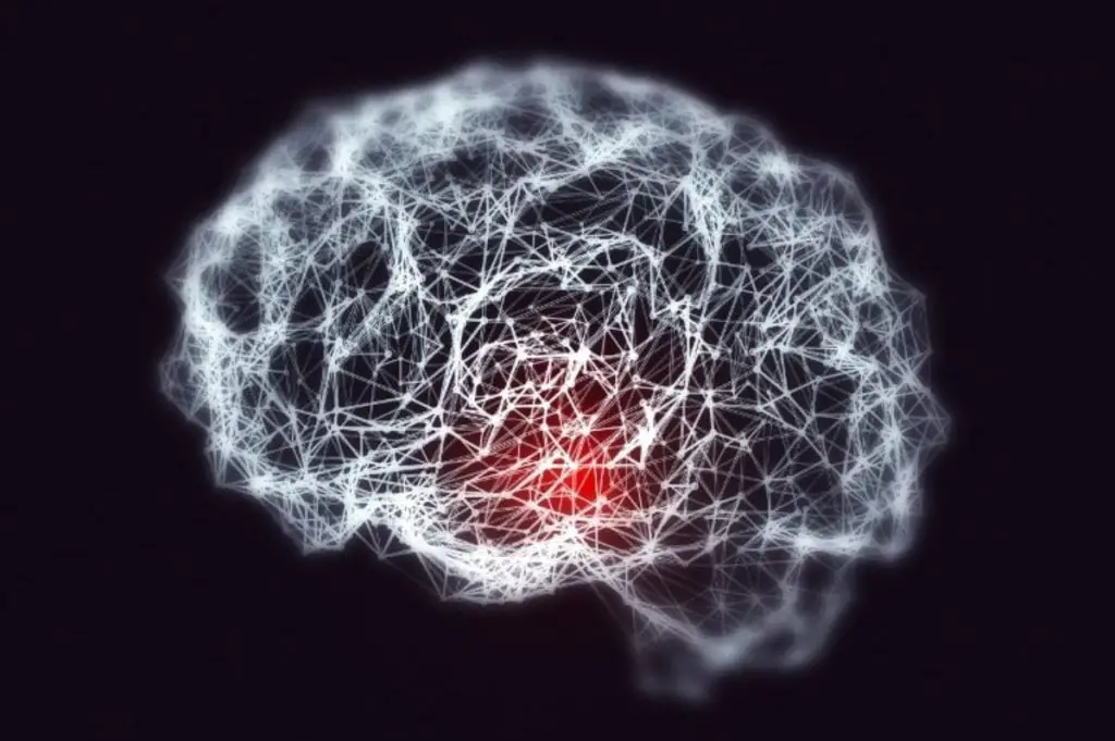 Neurodegenerazione, farmaci antinfiammatori, Alzheimer, lecanemab