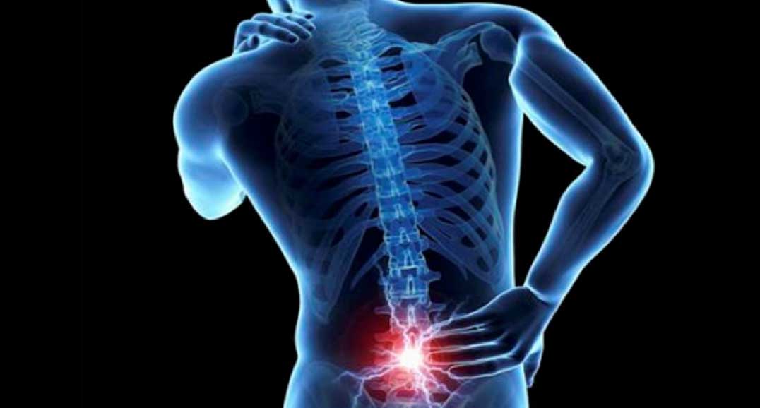 D-allosio e disco intervertebrale: può rallentare la degenerazione? %d-allosio e disco intervertebrale: può rallentare la degenerazione? Count(title)% Dolore alla schiena e disco intervertebrale