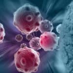 Quattro cambiamenti chiave tumori: un nuovo quadro per capire il cancro