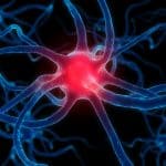 Parkinson: la riabilitazione con ai a casa funziona? Cosa mostra il trial