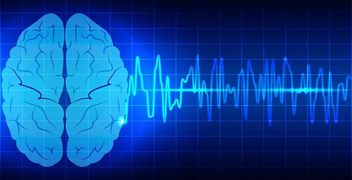 Invecchiamento cerebrale: l'apprendimento profondo identifica i geni chiave per prevenire l'alzheimer