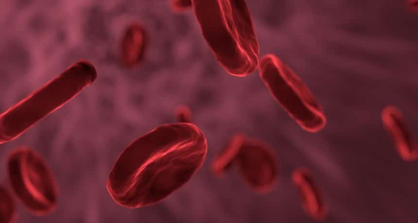 Anemia falciforme