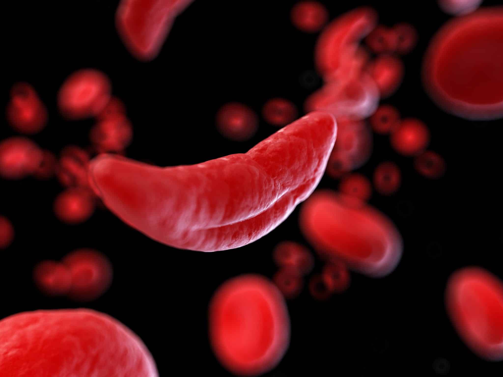 Emoglobina fetale: bach2 e nrf2 aprono una nuova strada? %emoglobina fetale: bach2 e nrf2 aprono una nuova strada? Count(title)% Anemia falciforme e globuli rossi