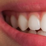 Hanno trovato davvero il modo di far ricrescere lo smalto dei denti? La nuova scoperta apre scenari enormi %hanno trovato davvero il modo di far ricrescere lo smalto dei denti? La nuova scoperta apre scenari enormicount(title)% Hanno trovato davvero il modo di far ricrescere lo smalto dei denti? La nuova scoperta apre scenari enormi