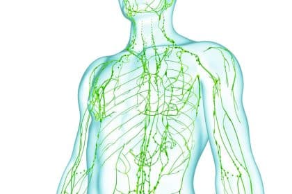 Linfedema