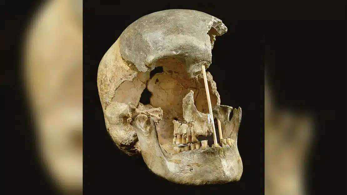Cenp-a: com'è fatto il nucleosoma del centromero nelle cellule umane? %cenp-a: com'è fatto il nucleosoma del centromero nelle cellule umane? Count(title)% Dna e cromatina nel nucleo cellulare