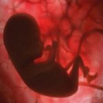 Autismo e incendi boschivi: il nuovo legame tra fumo intenso e sviluppo prenatale