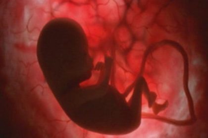 Diabete di tipo 1: lo stress cellulare inizia in gravidanza