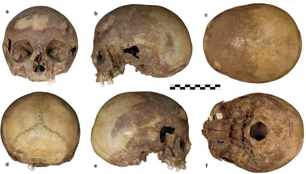 Il cranio di efeso rivela un segreto inaspettato sulla vita di cleopatra