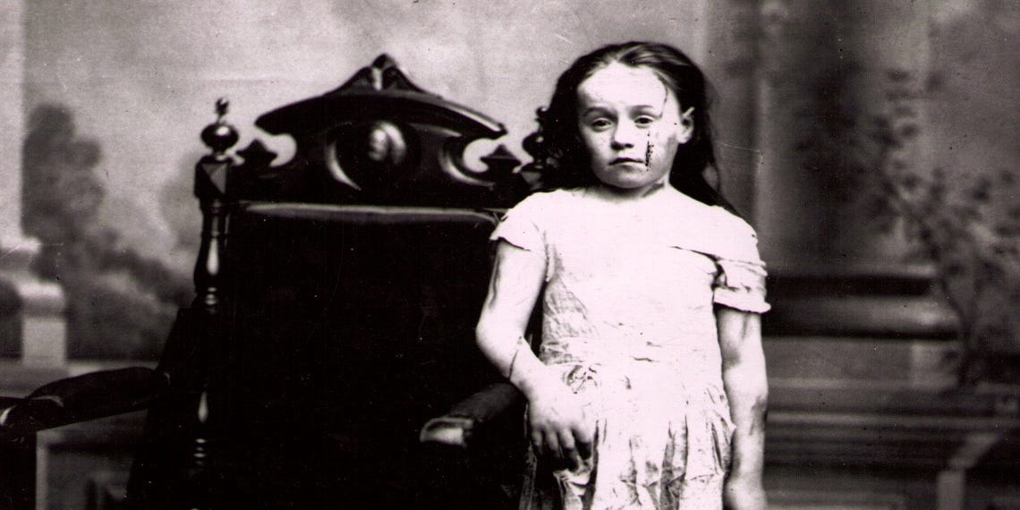 Mary ellen wilson: picchiata, affamata, umiliata. La bambina che a soli 10 anni lottò per il diritto all'infanzia