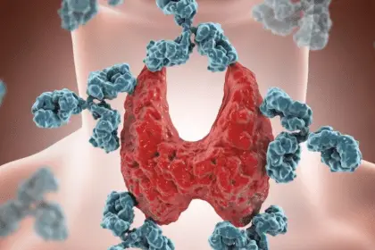 Cura della tiroidite di hashimoto: top 5 delle aree di ricerca più promettenti