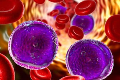 Progetto tumor profiler: 9 metodi molecolari rivoluzionano la cura dei tumori complessi