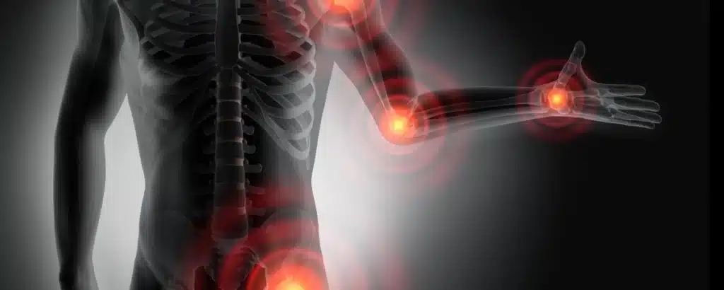 Fibromialgia: top 5 delle terapie più innovative ed efficaci %fibromialgia: top 5 delle terapie più innovative ed efficacicount(title)% Fibromialgia: top 5 delle terapie più innovative ed efficaci