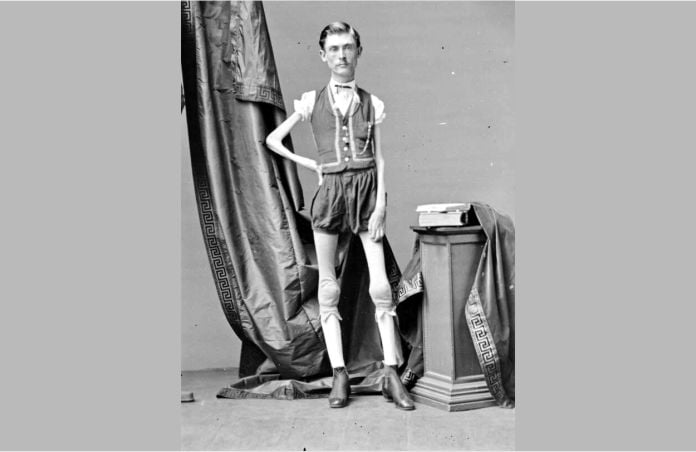 Benito alvarado: l'uomo fuori da ogni canone estetico al quale nessuna donna riusciva a resistere %benito alvarado: l'uomo fuori da ogni canone estetico al quale nessuna donna riusciva a resisterecount(title)% Benito alvarado: l'uomo fuori da ogni canone estetico al quale nessuna donna riusciva a resistere
